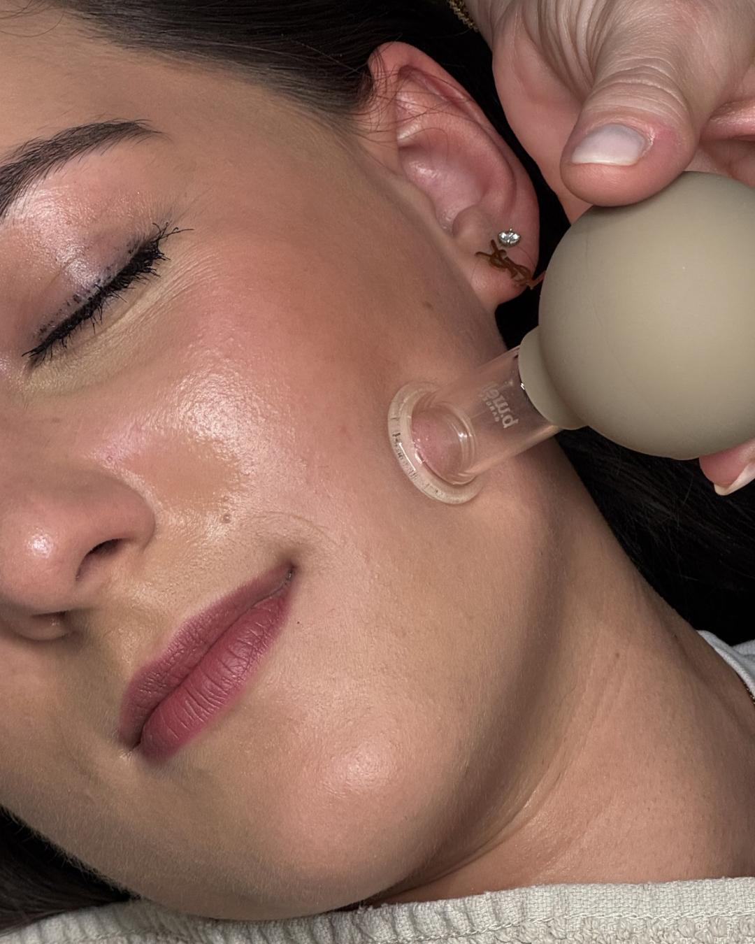 Face-Pilates-Behandlung mit Schröpfglas an der Wange – EINFACH SCHÖN KOSMETIKSTUDIO